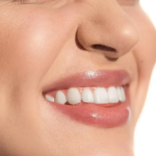 glossy smile, teeth whitening, aesthetic dental.