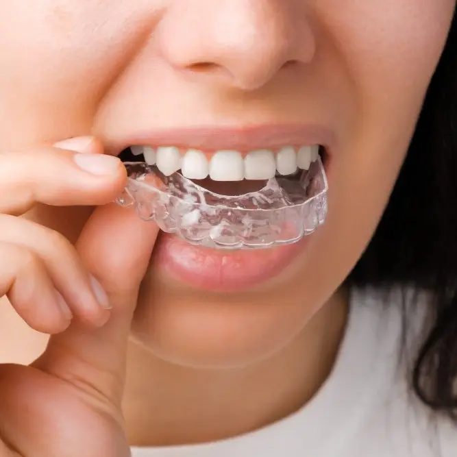 person-wearing-invisalign