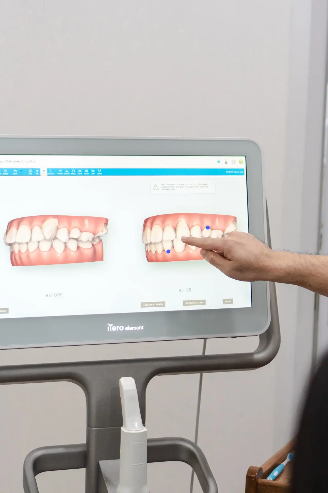iTero 3D technology at D. Dentist Clinic in Third Mile Branch